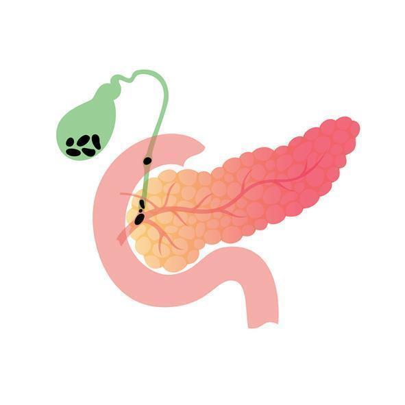 날로 이미지