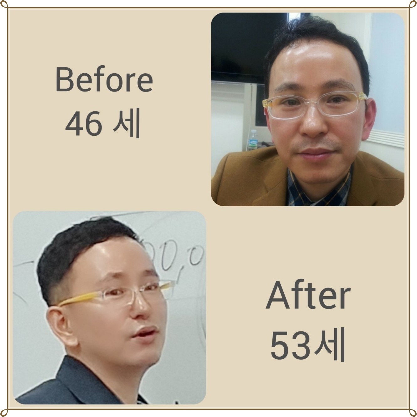 REMOZAR 리모사 리포좀 화장품 - ▶스킨독스 - 내일을 여는사람들.. 