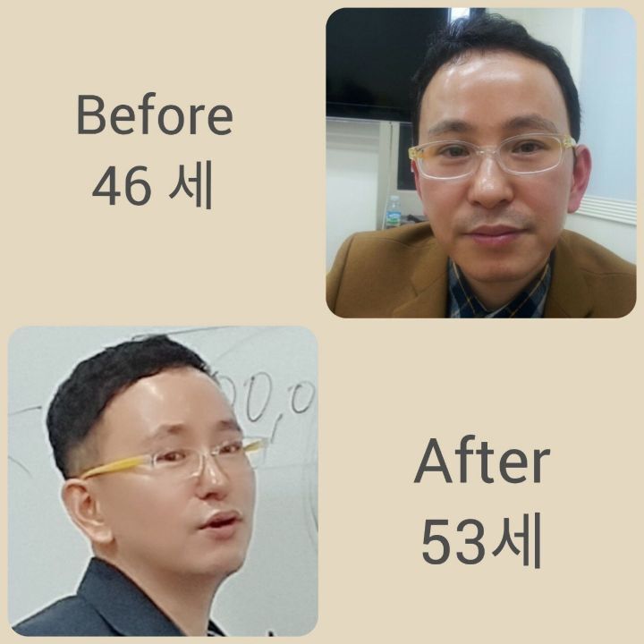 스킨독스 이미지