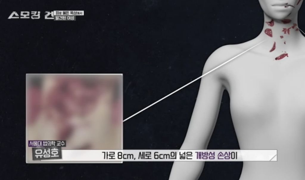 수능만점자 의대생이 여자친구 살해한 사건의 전말과 결과 | 인스티즈