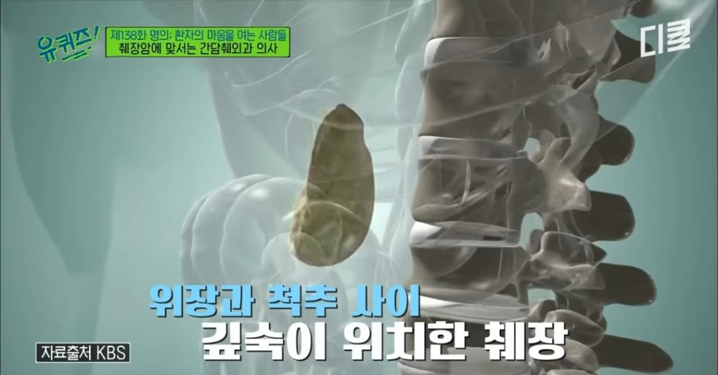 초기 발견이 어렵다는 췌장암이 의심되는 증상 | 인스티즈