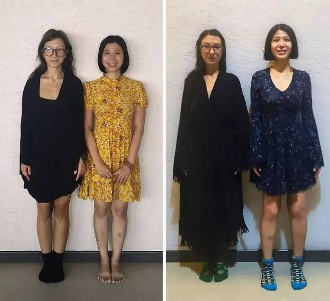 «Small Key Complex, augmentez 8,2 cm avec la chirurgie»… les femmes vietnamiennes dans la trentaine, avez-vous vu une intervention chirurgicale? -Si vous portez des méchants
