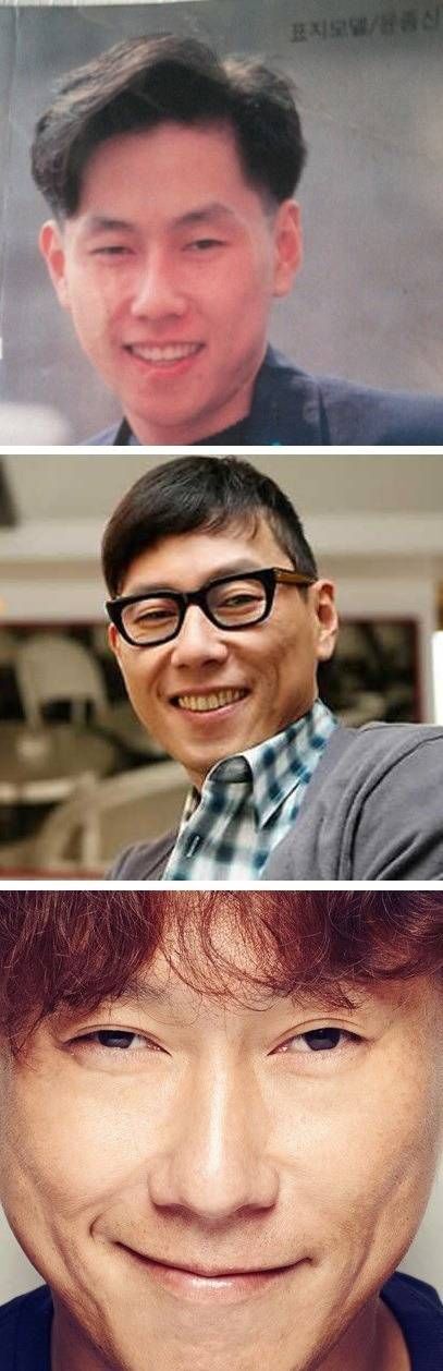 은근히 많이 생긴다는 '후천적 쌍꺼풀' | 인스티즈