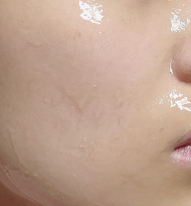 리뉴 이미지