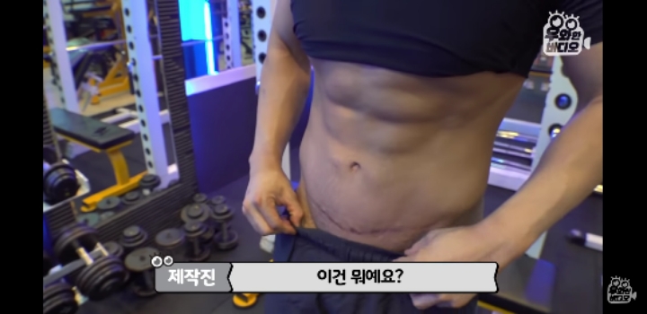 150키로 초고도비만 남자 5년만에 | 인스티즈