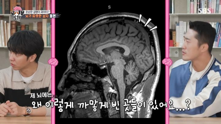 [집사부일체] 최고의 뇌과학자가 분석한 양세형, 리정, 이승기, 유수빈, 김동현 뇌 MRI 결과 | 인스티즈