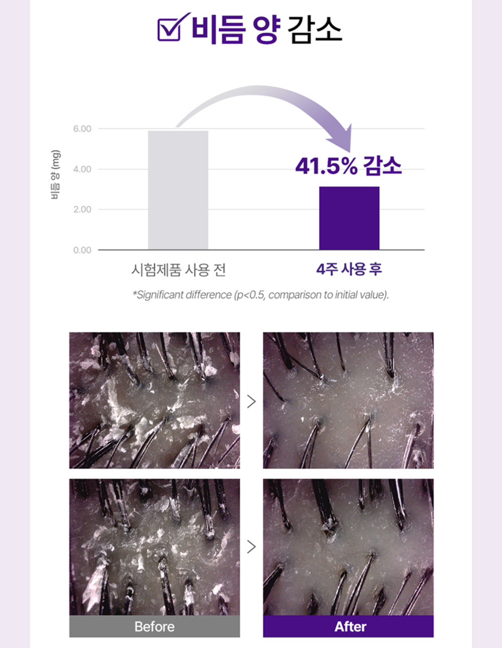리페어링 이미지