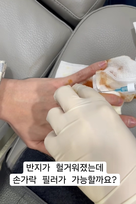 반지가 헐거워서 손가락에 필러맞은 사람,, | 인스티즈
