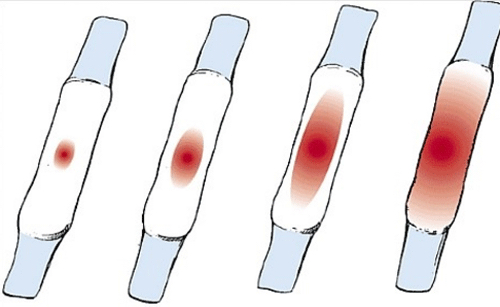 아무도 말해주지 않는 출산 후 오로 | 인스티즈