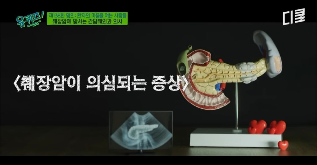 초기 발견이 어렵다는 췌장암이 의심되는 증상 | 인스티즈