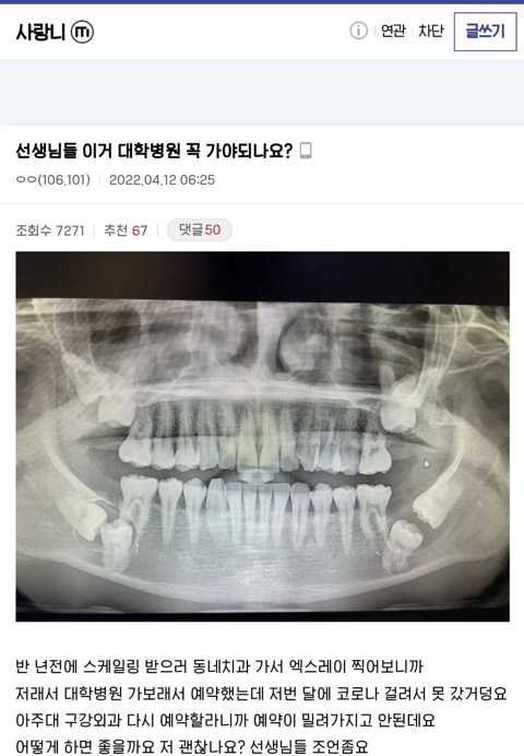 선생님들 이거 대학병원 꼭 가야하나요? 역대급 사랑니 수술후기 | 인스티즈