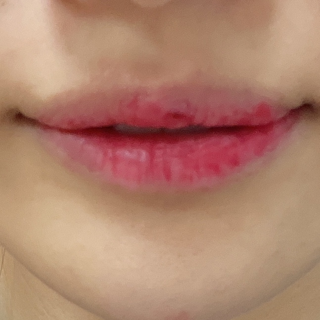 블러썸 이미지
