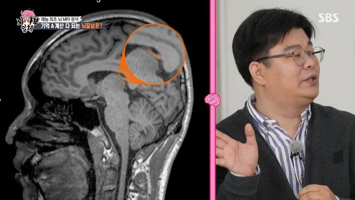 [집사부일체] 최고의 뇌과학자가 분석한 양세형, 리정, 이승기, 유수빈, 김동현 뇌 MRI 결과 | 인스티즈