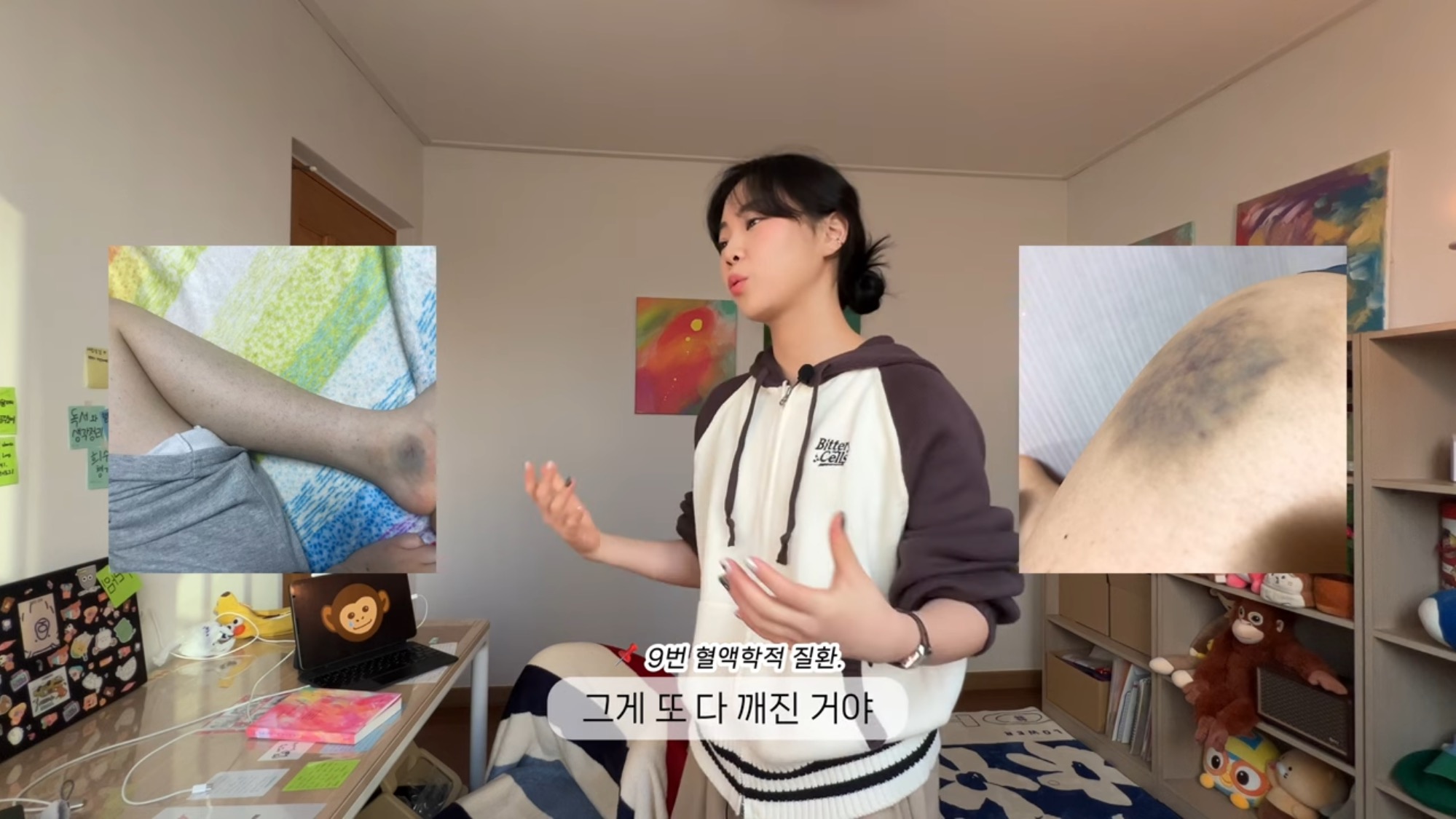 3년만에 희귀병 고백한 100만 유튜버 | 인스티즈