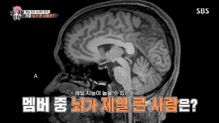 [집사부일체] 최고의 뇌과학자가 분석한 양세형, 리정, 이승기, 유수빈, 김동현 뇌 MRI 결과 | 인스티즈
