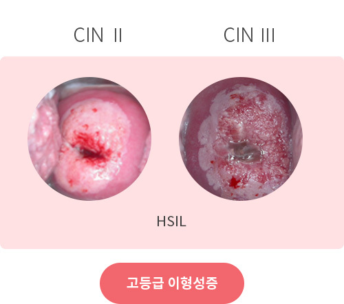 인달 이미지