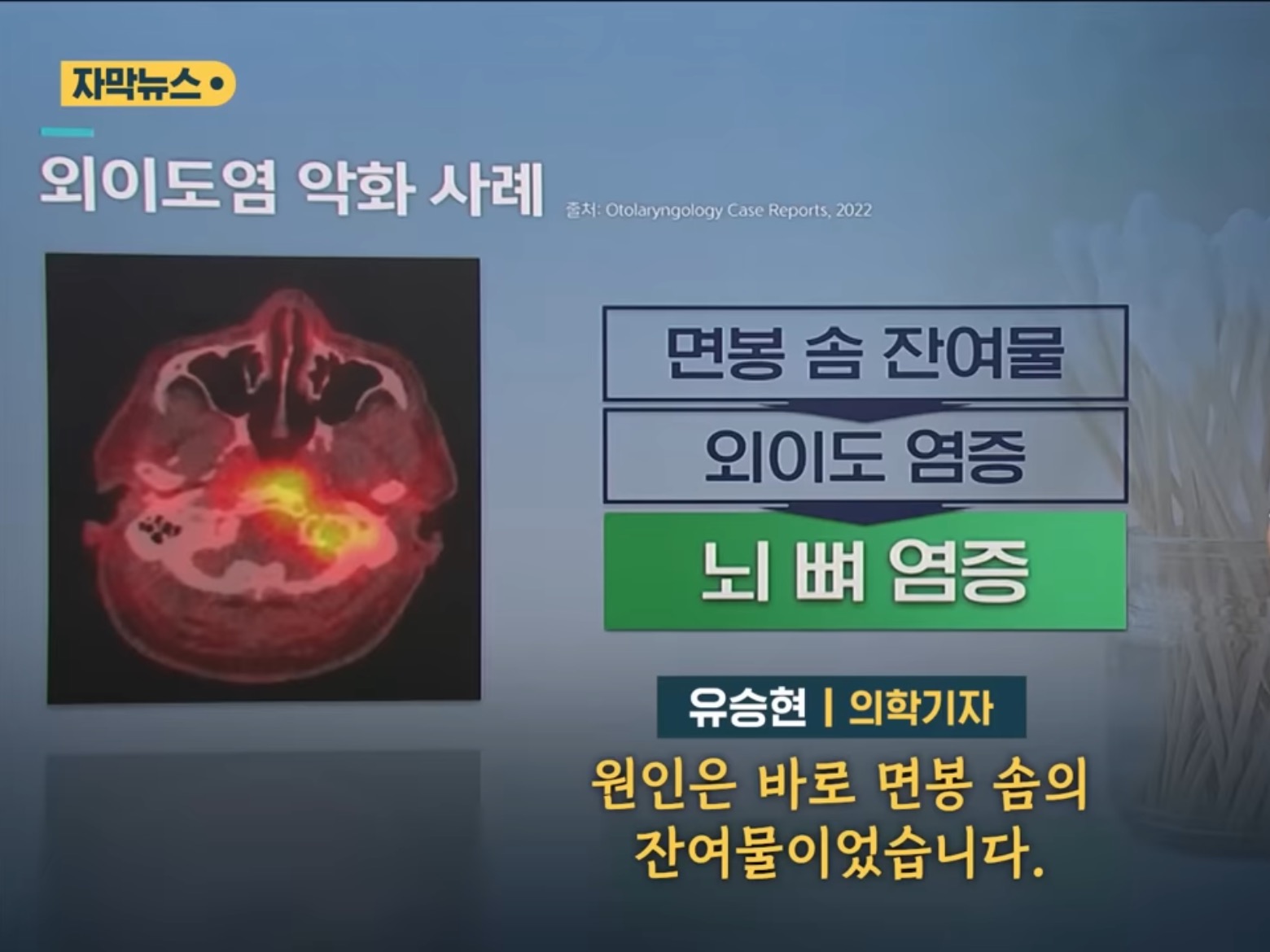 [SBS뉴스] "귓밥 못 참고 팠는데…” 상상도 못할 곳에 퍼졌다 | 인스티즈