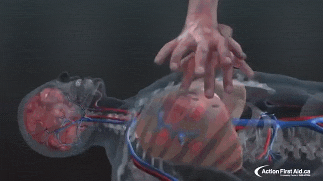 심폐소생술(CPR)을 하는동안 몸안에서 일어나는 일.gif | 인스티즈