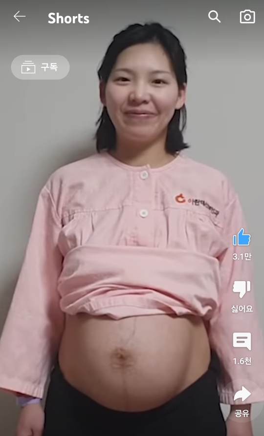 출산전후 직후 사진 | 인스티즈