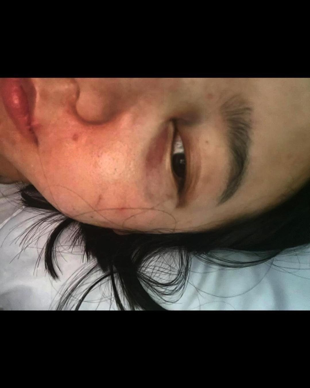 '결혼과이혼사이' 남편한테 폭행당했다는 서사랑 인스타 입장문.jpg (사진 트리거 주의) | 인스티즈