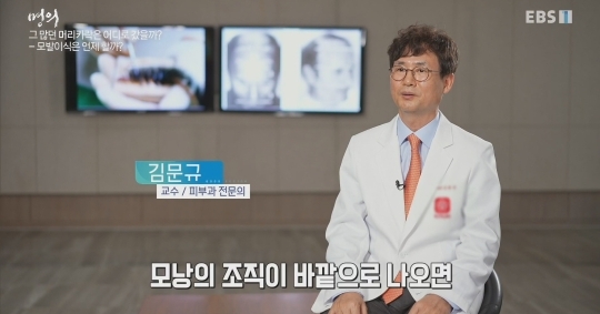 (주의) 실제 모발이식 장면.gif | 인스티즈