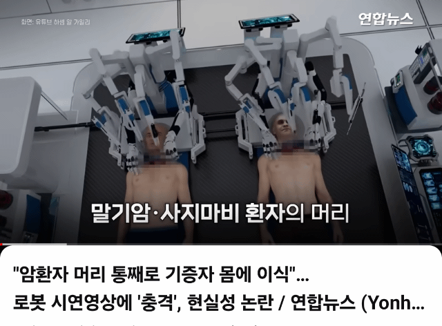 "암환자 머리 통째로 기증자 몸에 이식".. 로봇 시연영상에 '충격', 현실성 논란 (약간충격주의) | 인스티즈