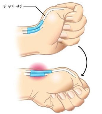 너무 무거운 것 같은 요즘 스마트폰 무게 | 인스티즈
