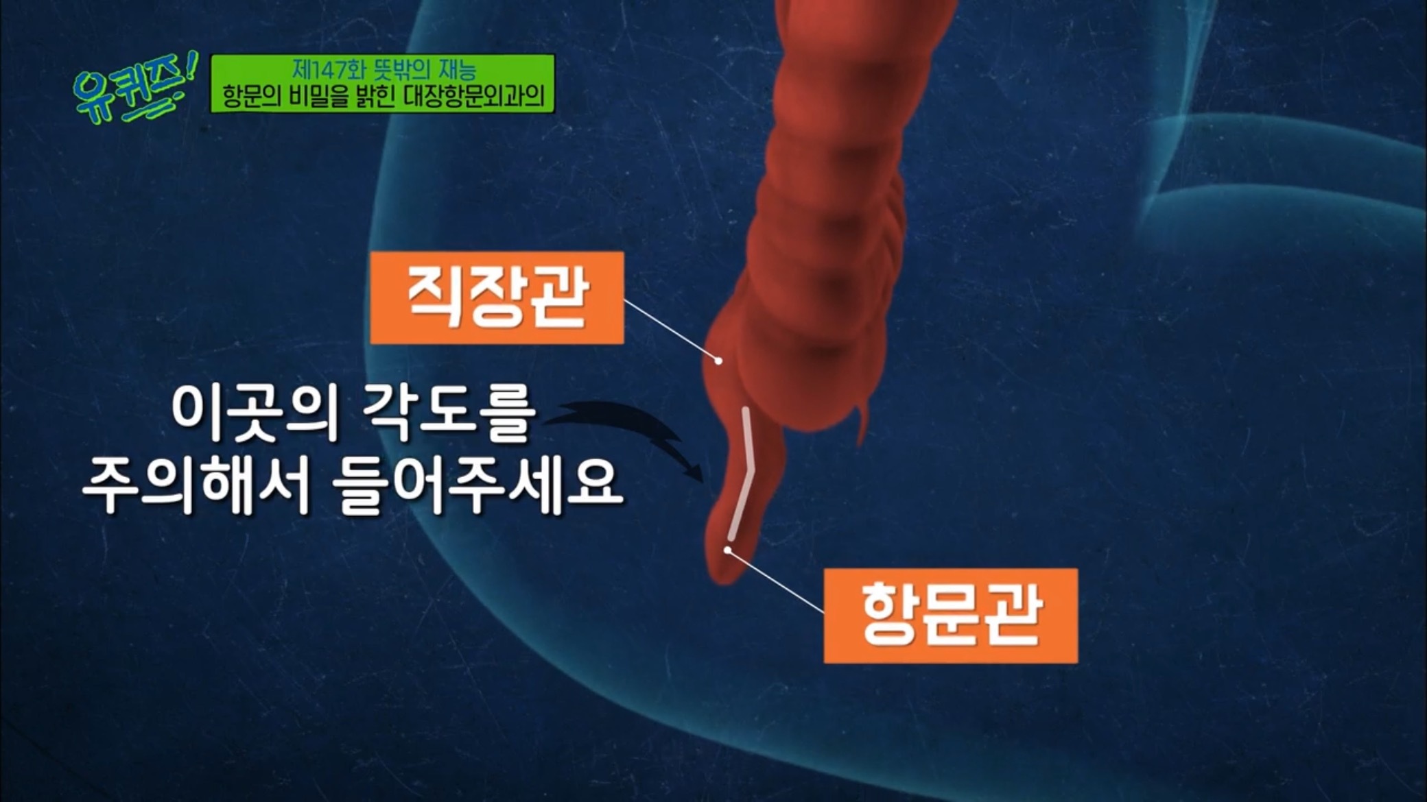더쿠 - 똥꼬 의사가 말해주는 급똥 참는 법.jpg
