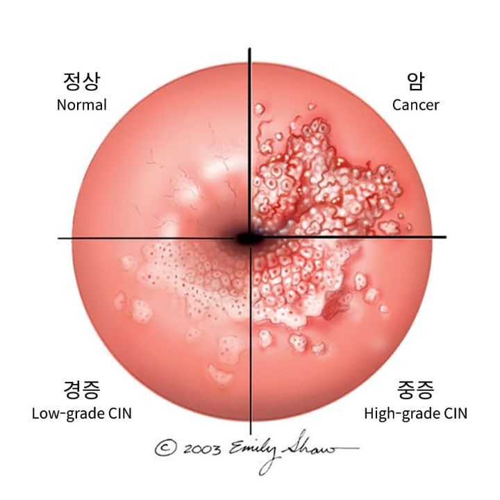 인달 이미지