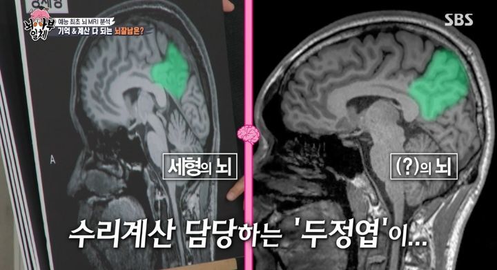 [집사부일체] 최고의 뇌과학자가 분석한 양세형, 리정, 이승기, 유수빈, 김동현 뇌 MRI 결과 | 인스티즈