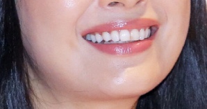 하관만 보고 여자연예인 누군지 맞히기 | 인스티즈