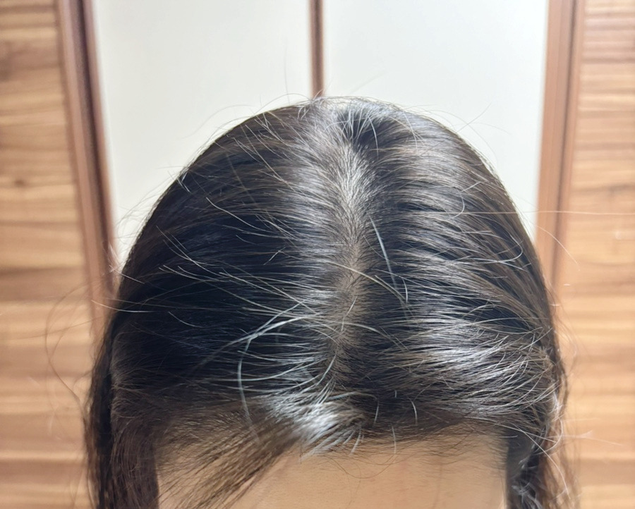 토닉 이미지