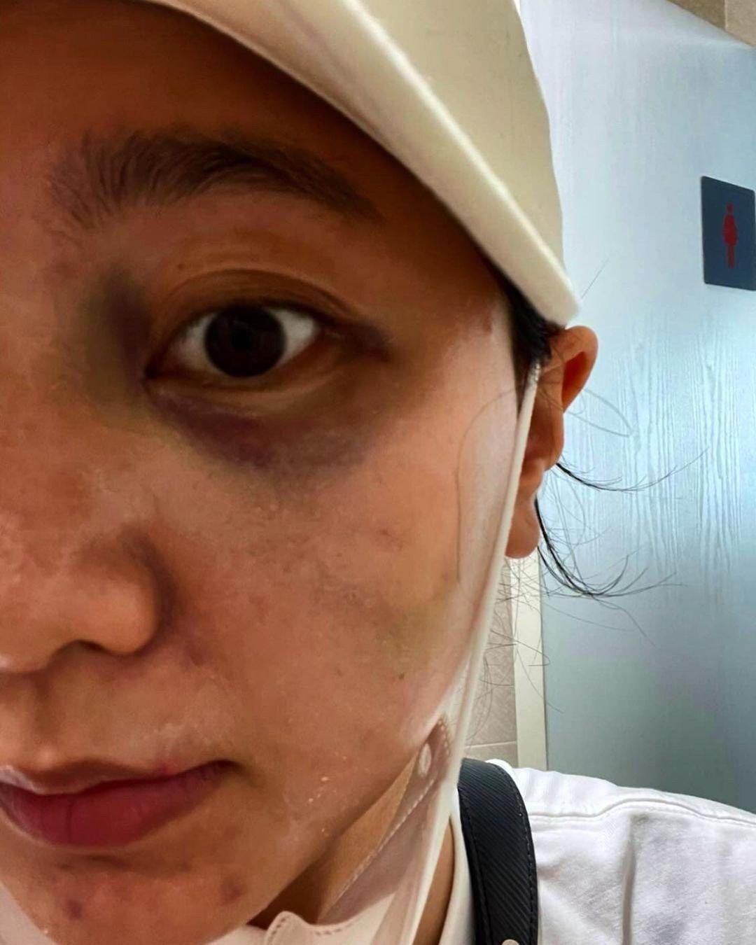 '결혼과이혼사이' 남편한테 폭행당했다는 서사랑 인스타 입장문.jpg (사진 트리거 주의) | 인스티즈