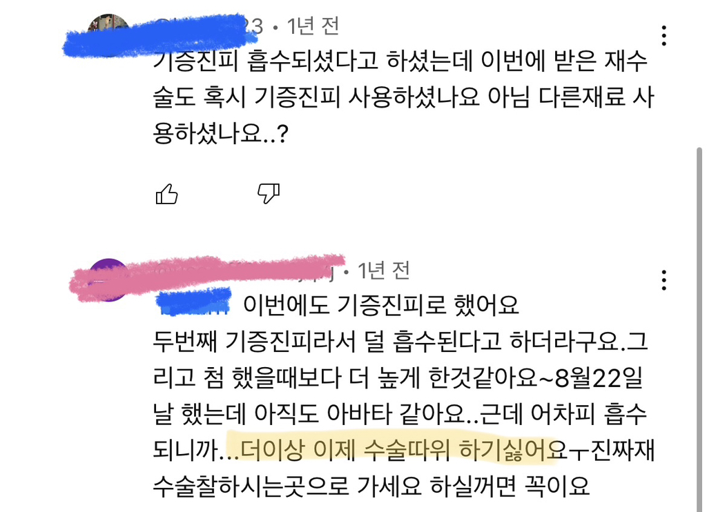 코수술 부작용으로 인한 코끝 꺼짐 + 자가진피 코수술 후기 | 인스티즈