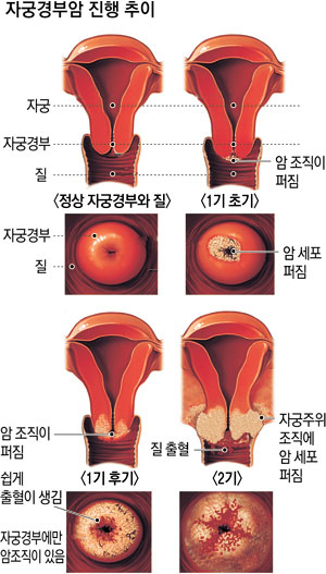 인달 이미지