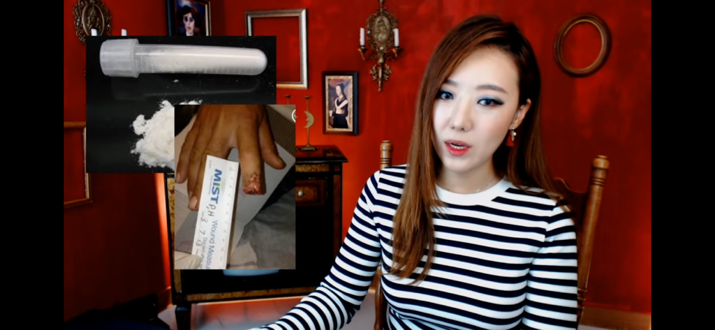 돼지 방광으로 잘린손가락 재생사례(손가락사진 주의) | 인스티즈