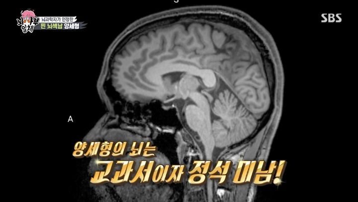 [집사부일체] 최고의 뇌과학자가 분석한 양세형, 리정, 이승기, 유수빈, 김동현 뇌 MRI 결과 | 인스티즈