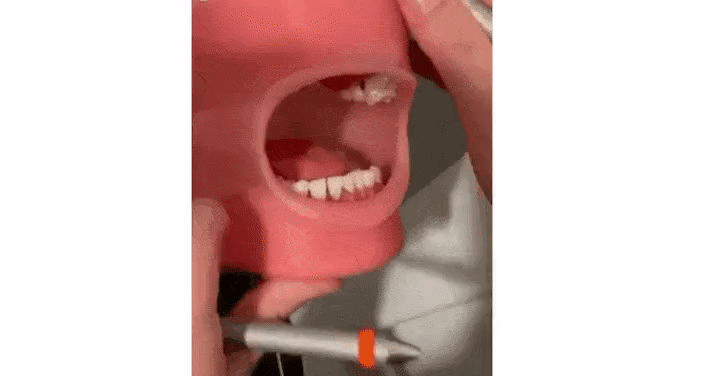 치과에서 의사가 원하는 입 벌리기.gif | 인스티즈