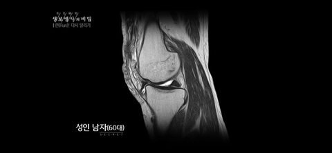 러닝만큼 가성비 넘치고 정신건강에 좋은운동 없다고 생각하는 달글 | 인스티즈