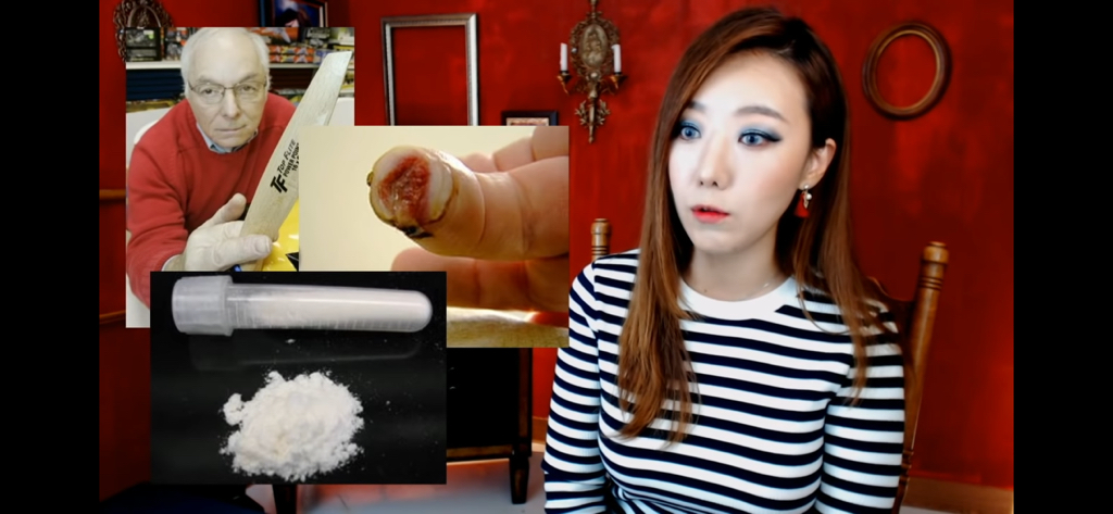 돼지 방광으로 잘린손가락 재생사례(손가락사진 주의) | 인스티즈