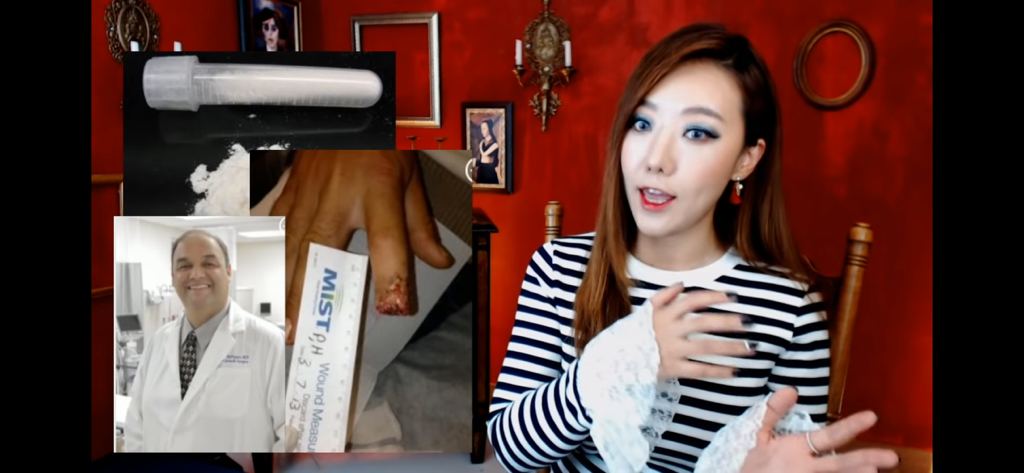 돼지 방광으로 잘린손가락 재생사례(손가락사진 주의) | 인스티즈