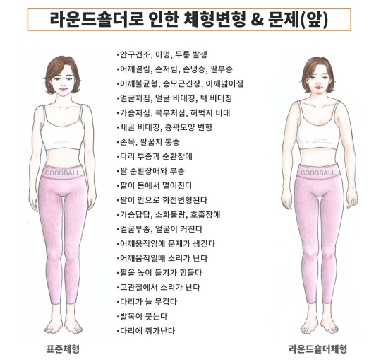 라운드숄더로 인한 체형 변형 앞&뒤&옆 | 인스티즈