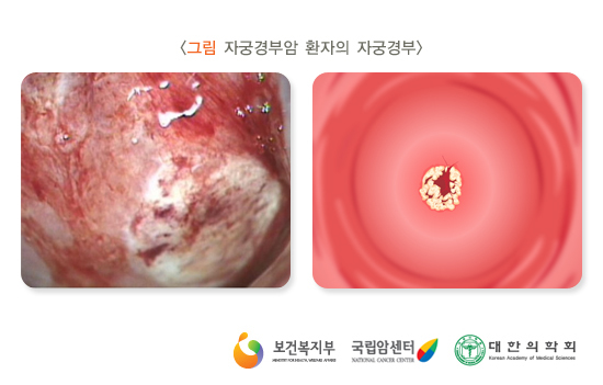 인달 이미지