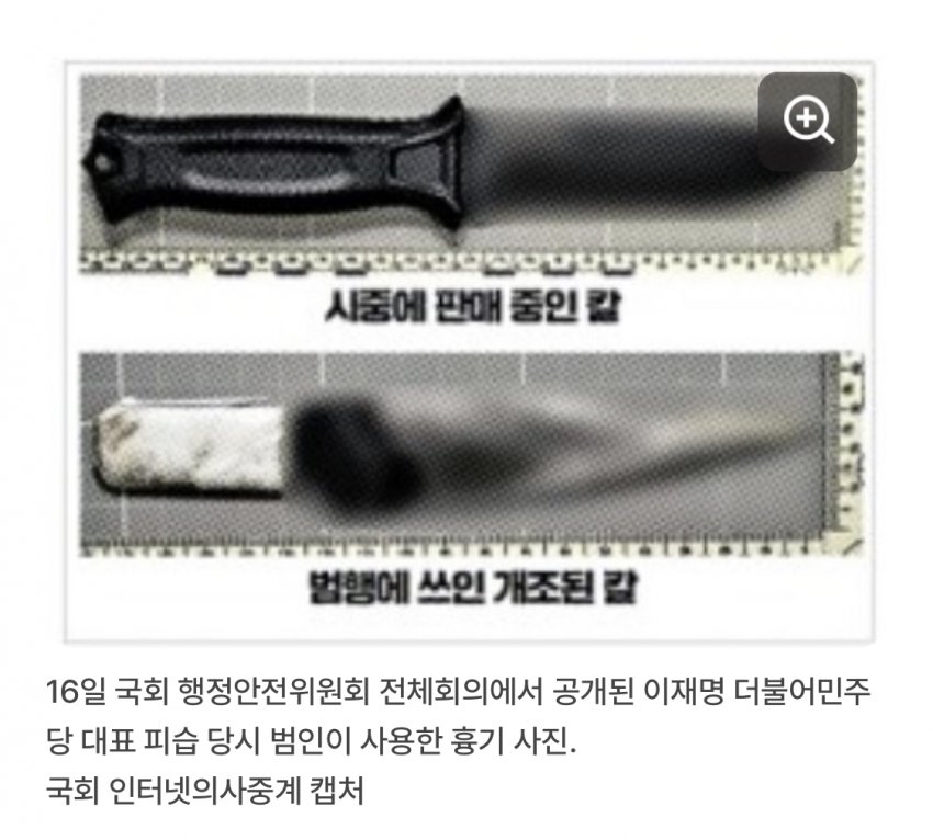 이재명 칼테러 사건의 상처크기 | 인스티즈