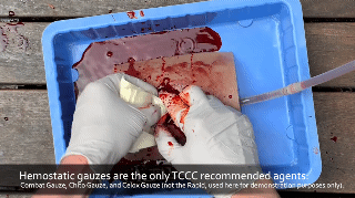 지혈하면 기절하는 이유 | 인스티즈