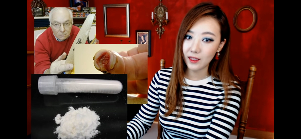 돼지 방광으로 잘린손가락 재생사례(손가락사진 주의) | 인스티즈