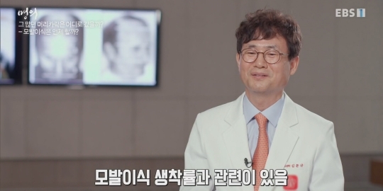 (주의) 실제 모발이식 장면.gif | 인스티즈