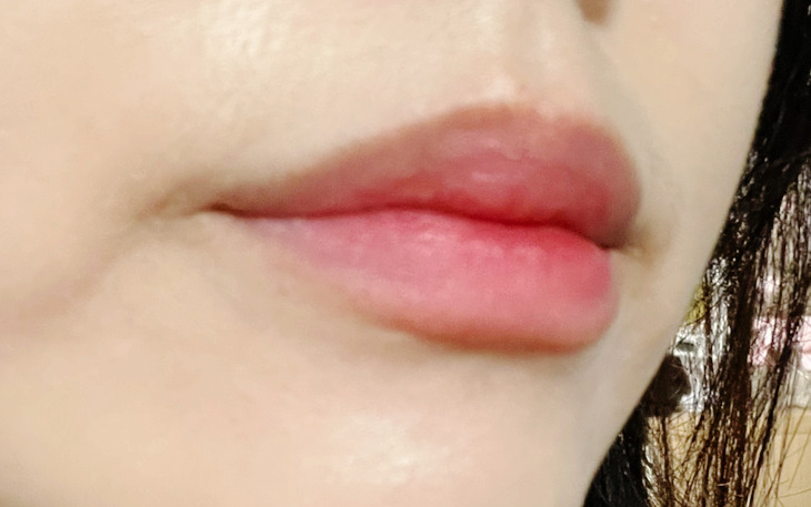 블러썸 이미지
