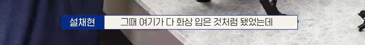 교통사고난 유기견 입양한 설채현 수의사 그리고 윙크 근황😉 | 인스티즈