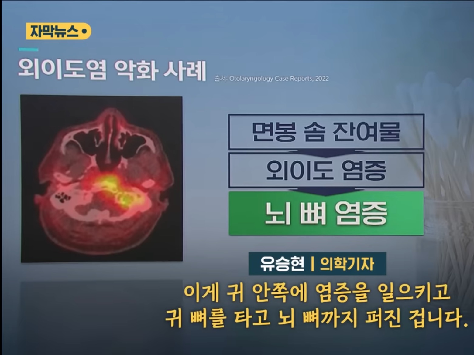 [SBS뉴스] "귓밥 못 참고 팠는데…” 상상도 못할 곳에 퍼졌다 | 인스티즈
